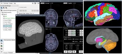 MEG/EEG Group Analysis With Brainstorm